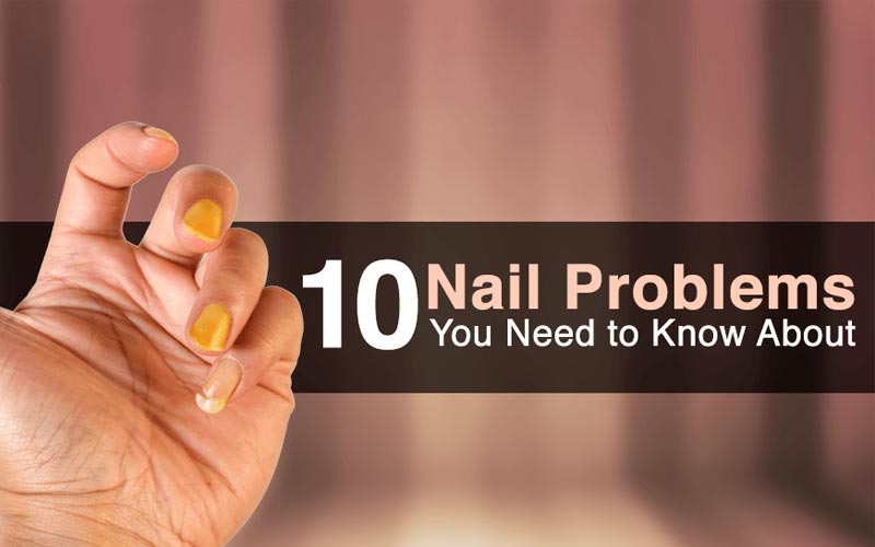fingernail problems