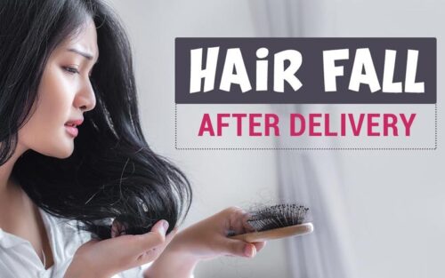 Hair Fall After Delivery Dr Walia s Skin And Laser Clinic