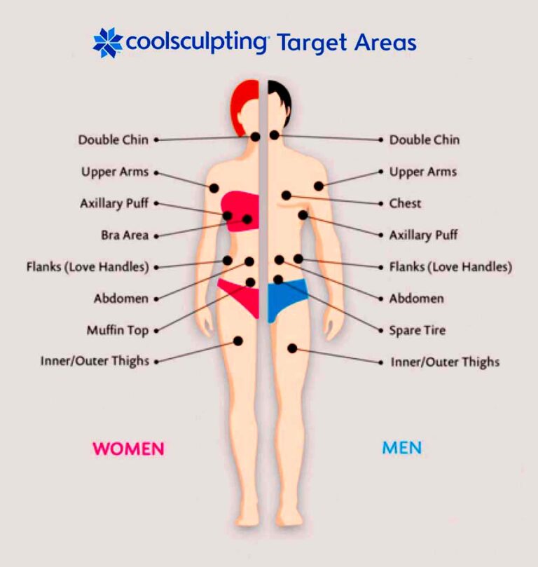 coolsculpting target areas